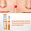 VC Whitening Instant Blemish Pen Remove Melasma Pigment Melanin Dark Spot Gel Freckle Cream Face Brighten Skin Repair Anti Aging