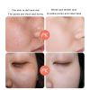 Anti Stains Acne Treatment Cream Scar Blackhead Face Cream Shrink Pores Whitening Skin Care Face Cream Korean Cosmetics