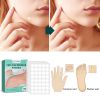 Warts Remover Patch Skin Tags Pimple Treatment Cream Hydrocolloid Gel Mole Wart Meat Grain Flat Silk Warts Invisible Stickers