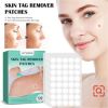 Warts Remover Patch Skin Tags Pimple Treatment Cream Hydrocolloid Gel Mole Wart Meat Grain Flat Silk Warts Invisible Stickers