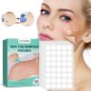 Warts Remover Patch Skin Tags Pimple Treatment Cream Hydrocolloid Gel Mole Wart Meat Grain Flat Silk Warts Invisible Stickers